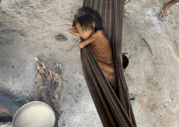Criança Yanomami com desnutrição e malária, na aldeia Maimasi.
Foto: Divulgação