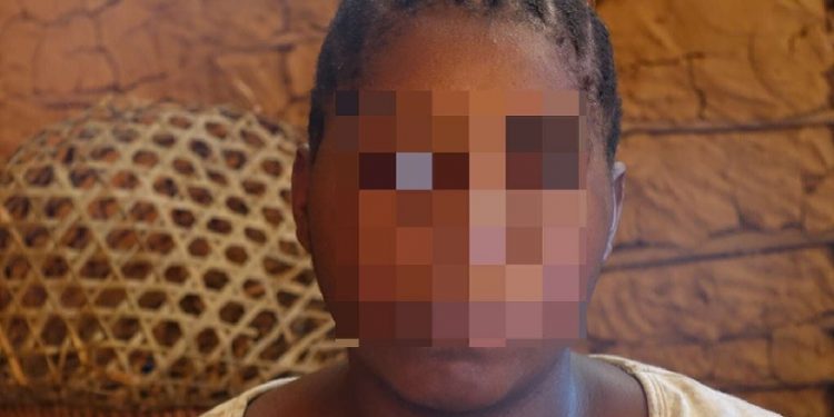 Esta mulher Baka foi estuprada por um guarda florestal do African Parks. “O African Parks são pessoas muito ruins. Todo mundo que trabalha lá é muito ruim com a gente. Aquele homem foi cruel, ele foi desumano.” © Survival Esta mulher Baka foi estuprada por um guarda florestal do African Parks. “O African Parks são pessoas muito ruins. Todo mundo que trabalha lá é muito ruim com a gente. Aquele homem foi cruel, ele foi desumano.” © Survival
