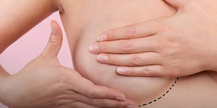 Evento aborda prevenção e tratamento da doença em Foz do Iguaçu e região - imagem ilustrativa: Sociedade Brasileira de Mastologia Evento aborda prevenção e tratamento da doença em Foz do Iguaçu e região - imagem ilustrativa: Sociedade Brasileira de Mastologia
