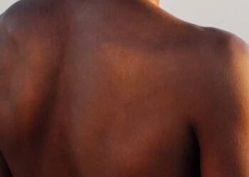 Foto: Instituto Melanoma Brasil/Capa Vídeo