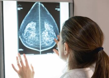 Mamografias no SUS em pacientes com menos de 50 anos representam 30% do total, equivalente a mais de 1 milhão em 2024. Foto: GettyImages Mamografias no SUS em pacientes com menos de 50 anos representam 30% do total, equivalente a mais de 1 milhão em 2024. Foto: GettyImages