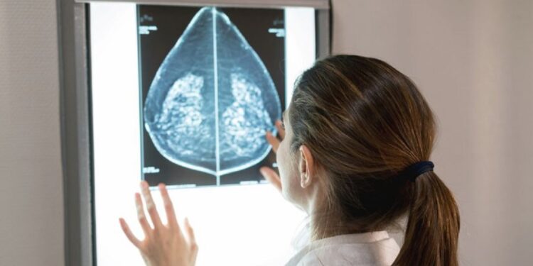Mamografias no SUS em pacientes com menos de 50 anos representam 30% do total, equivalente a mais de 1 milhão em 2024. Foto: GettyImages Mamografias no SUS em pacientes com menos de 50 anos representam 30% do total, equivalente a mais de 1 milhão em 2024. Foto: GettyImages