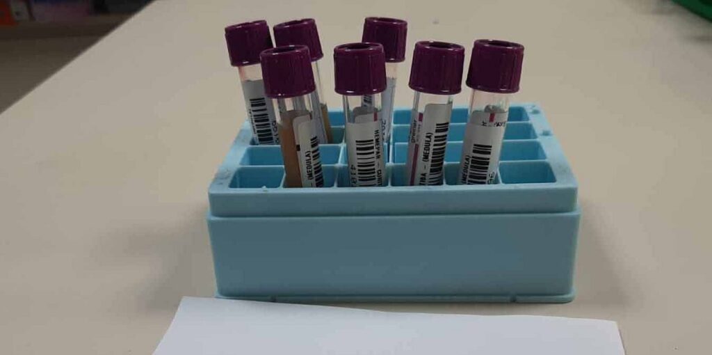Paraná registrou quase 300 transplantes de medula óssea em 2025 Foto: SESA